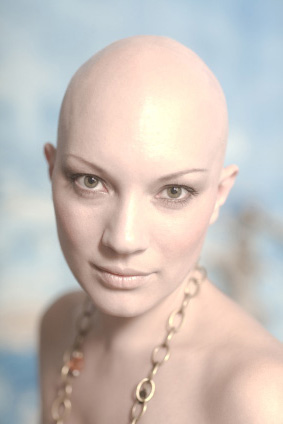 Bald Women 53