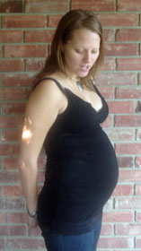Hiar loss and some baldness during pregnancy is common, but little talked about, so very scary when it happens.